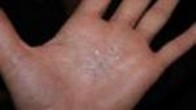 Сапфировые частицы на руке
