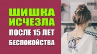 Шишка, беспокоившая 15 лет, исчезла после молитвы