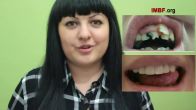 Money for dental restoration—now she can smile