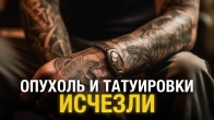 Чудеса перед операцией: опухоль и татуировки исчезли!