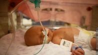 A Child on Life Support from the First Day—Alive and Well After the Church’s Prayer