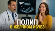 Gallbladder Healing: How a Polyp Disappeared Through Prayer | A Miracle of God
