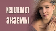 После служения я исцелилась от экземы, которая мучила меня полгода